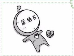 腎結石患者的飲食禁忌